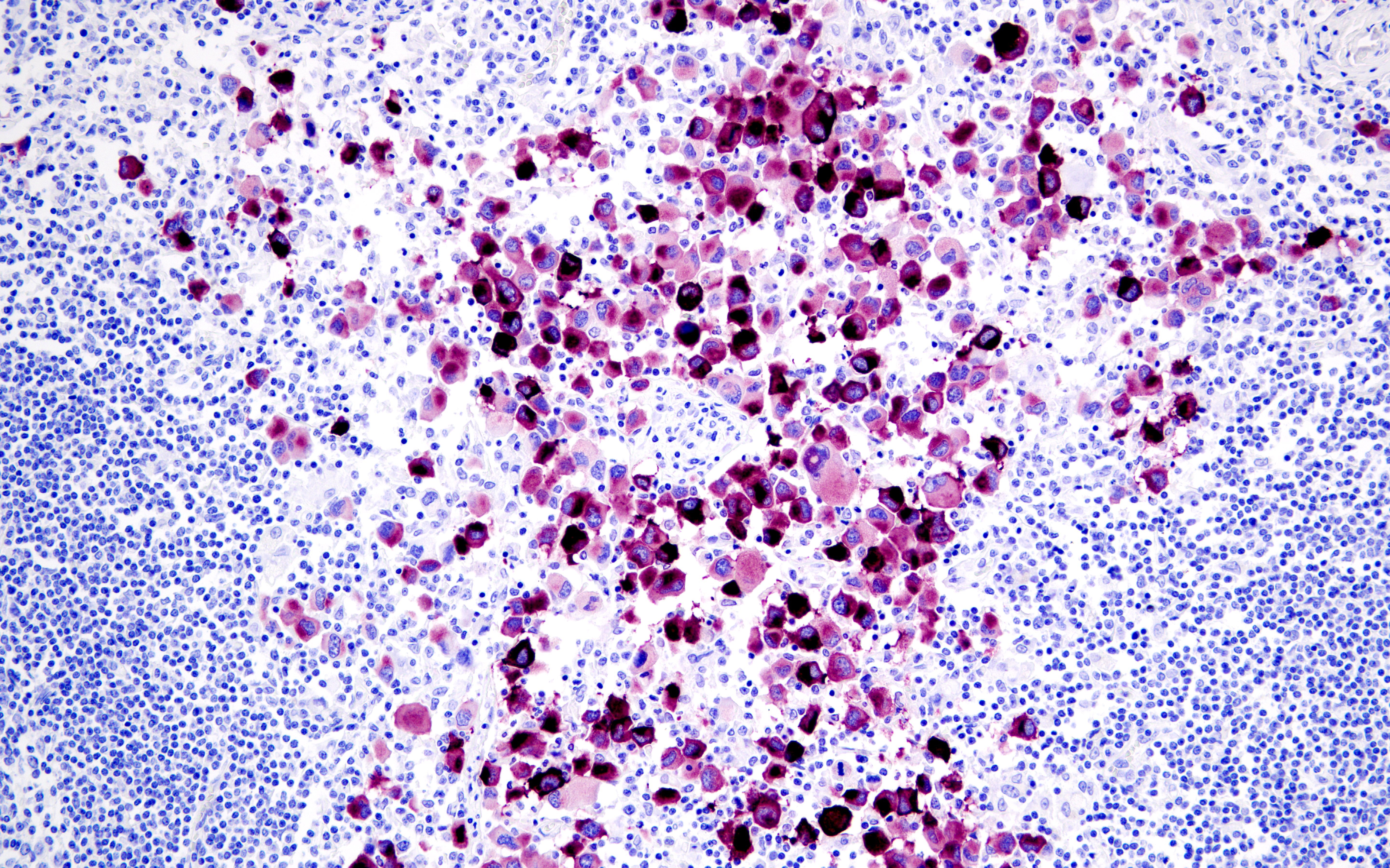 刻まれた21センチ 血管腫と共に生きる 刻まれた21センチ―血管